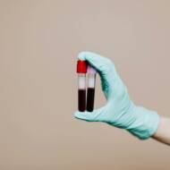 blood test