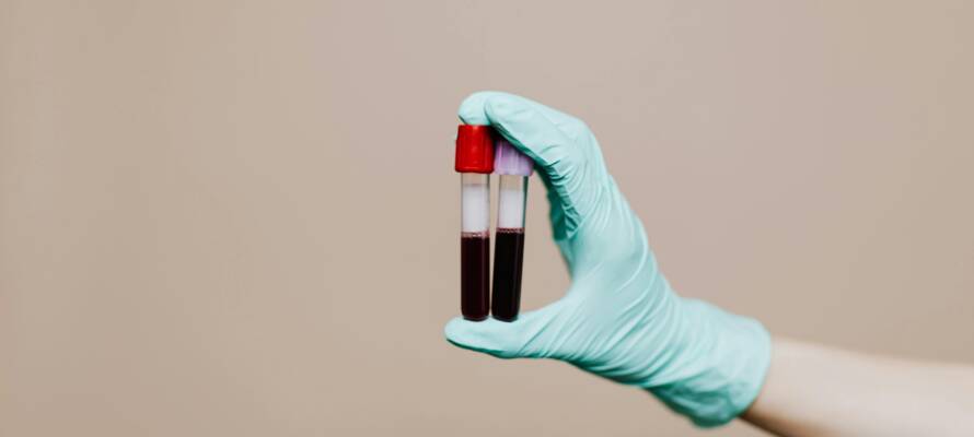 blood test