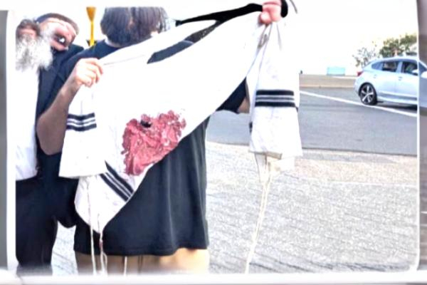 Bloody Tallit katan